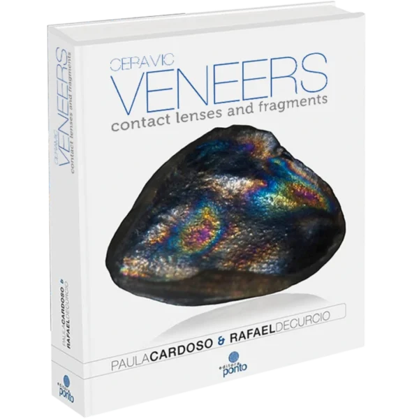 Ceramic veneers: contact lenses and fragments