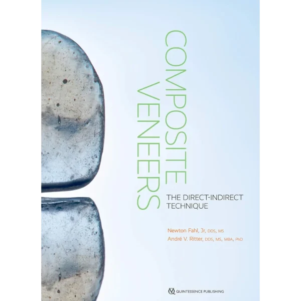 Composite Veneers: The Direct-Indirect Technique