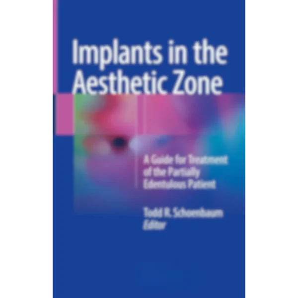 Implants in the Aesthetic Zone: A Guide for Treatment of the Partially Edentulous Patient