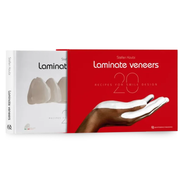 Laminate Veneers: 20 Recipes for Smile Design