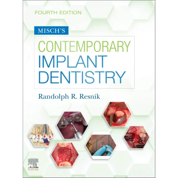 Misch's Contemporary Implant Dentistry: Misch's Contemporary Implant Dentistry E-Book