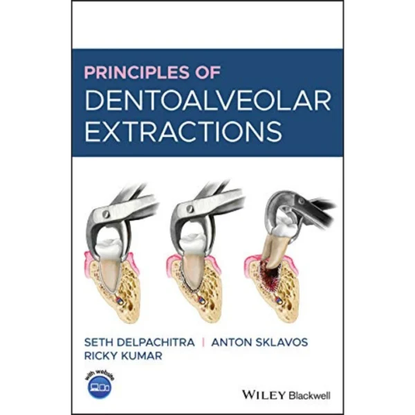 Principles of Dentoalveolar Extractions