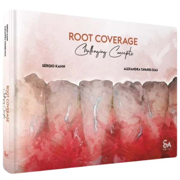 Root Coverage – Challenging Concepts