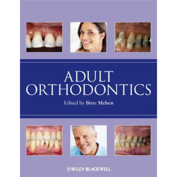 Adult Orthodontics