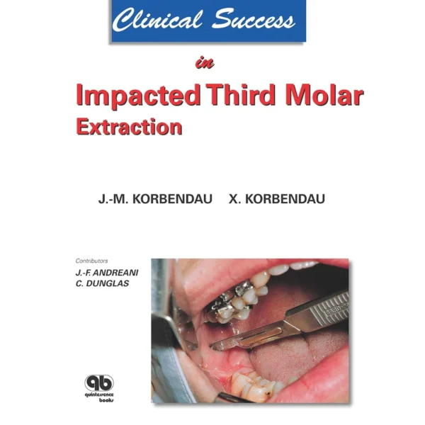 Clinical Success in Impacted Third Molar Extraction