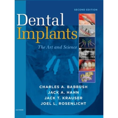 Dental Implants The Art and Science Dental Implants: The Art and Science