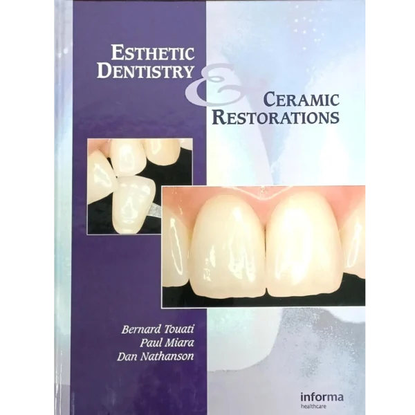 Esthetic Dentistry and Ceramic Restoration