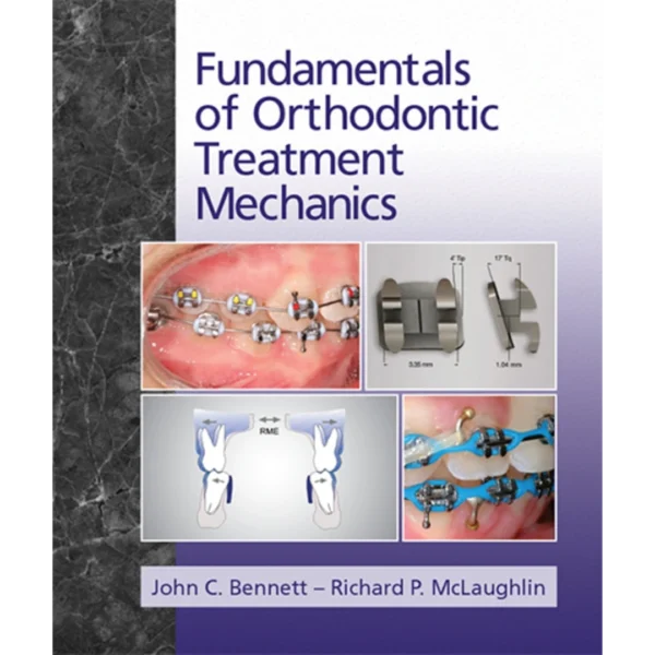 Fundamentals of Orthodontic Treatment Mechanics