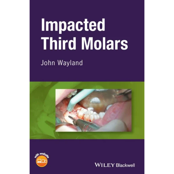Impacted Third Molars