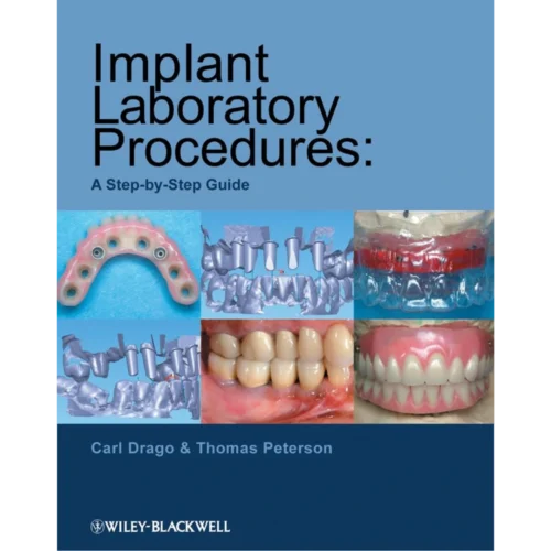 Implant Laboratory Procedures A Step-by-Step Guide Implant Laboratory Procedures A Step-by-Step Guide