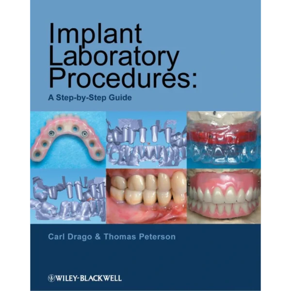 Implant Laboratory Procedures A Step-by-Step Guide