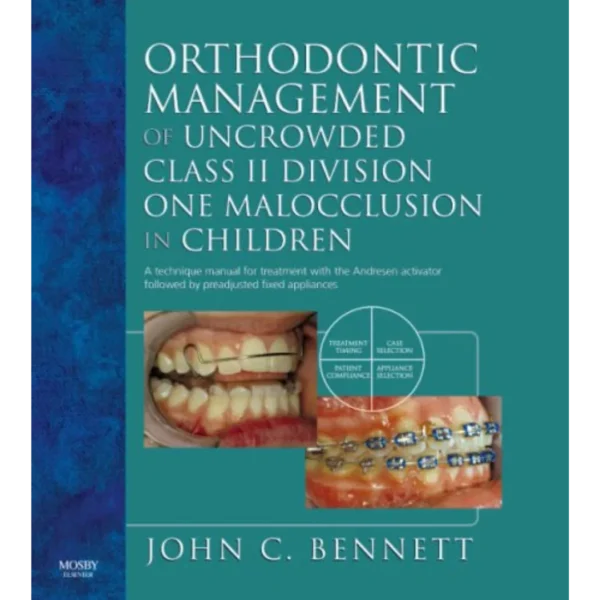 Orthodontic Management of Uncrowded Class II Division One Malocclusion in Children