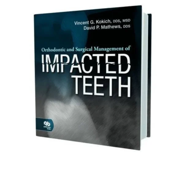 Orthodontic and Surgical Management of Impacted Teeth