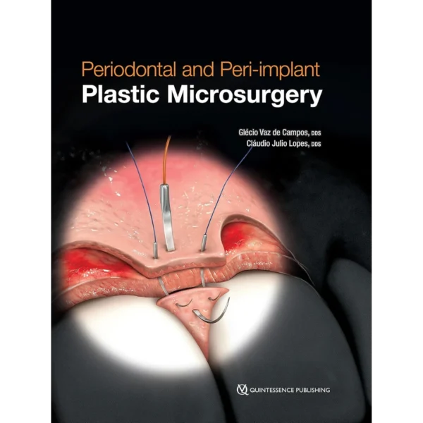 Periodontal and Peri-implant Plastic Microsurgery: Minimally Invasive Techniques with Maximum Precision