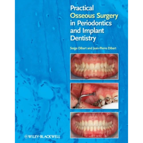 Practical Osseous Surgery in Periodontics and Implant Dentistry Practical Osseous Surgery in Periodontics and Implant Dentistry