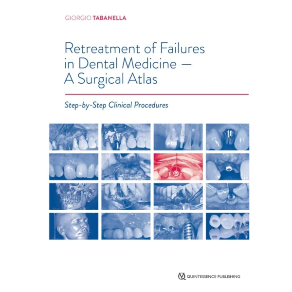 Retreatment of Failures in Dental Medicine: A Surgical Atlas: Step-by-Step Clinical Procedures