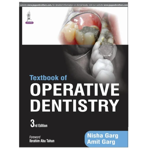 Textbook of Operative Dentistry Textbook of Operative Dentistry