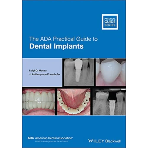 The ADA Practical Guide to Dental Implants