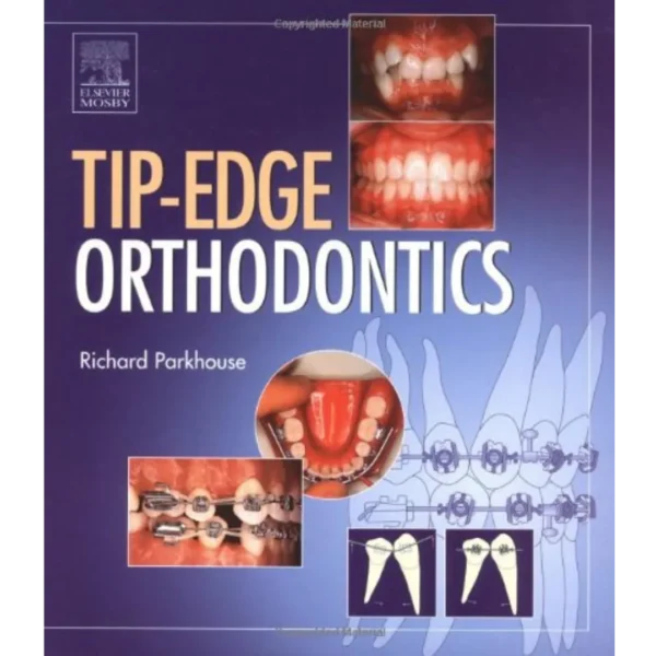 The Tip-Edge Orthodontic System The Tip-Edge Orthodontic System
