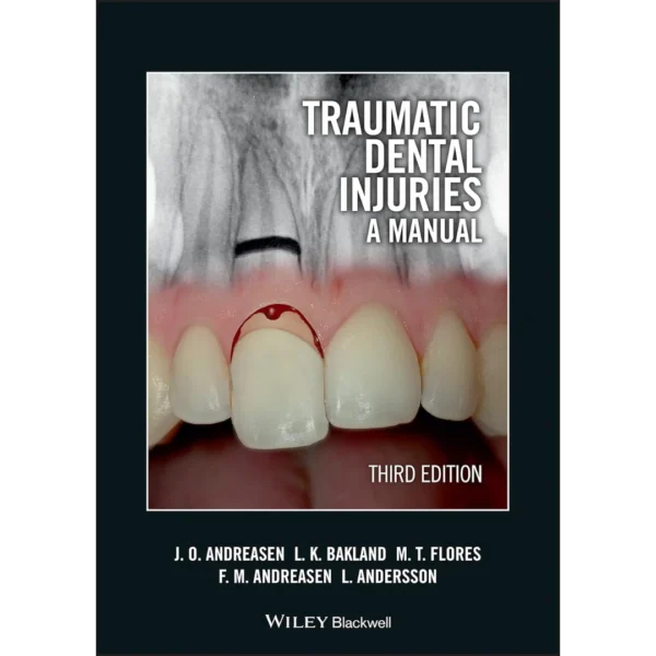 Traumatic Dental Injuries Traumatic Dental Injuries