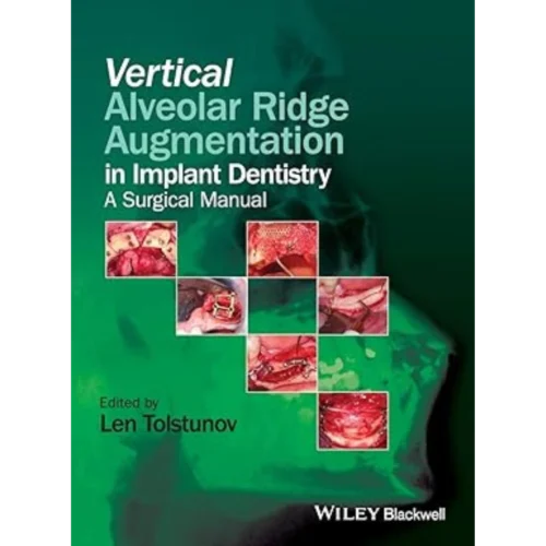 Vertical Alveolar Ridge Augmentation in Implant Dentistry