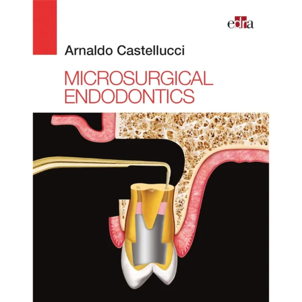 Microsurgical Endodontics