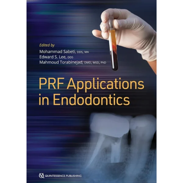 PRF Applications in Endodontics