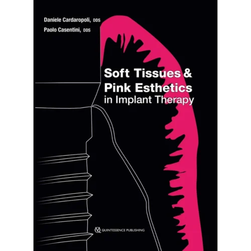 Soft Tissues and Pink Esthetics in Implant Therapy