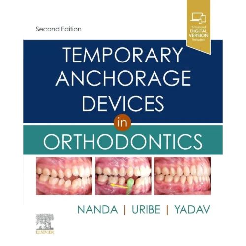 Temporary Anchorage Devices in Orthodontics 2nd Edition