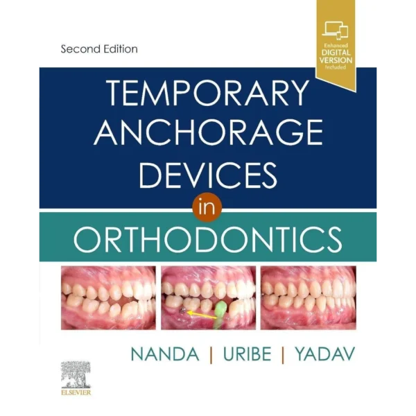 Temporary Anchorage Devices in Orthodontics 2nd Edition
