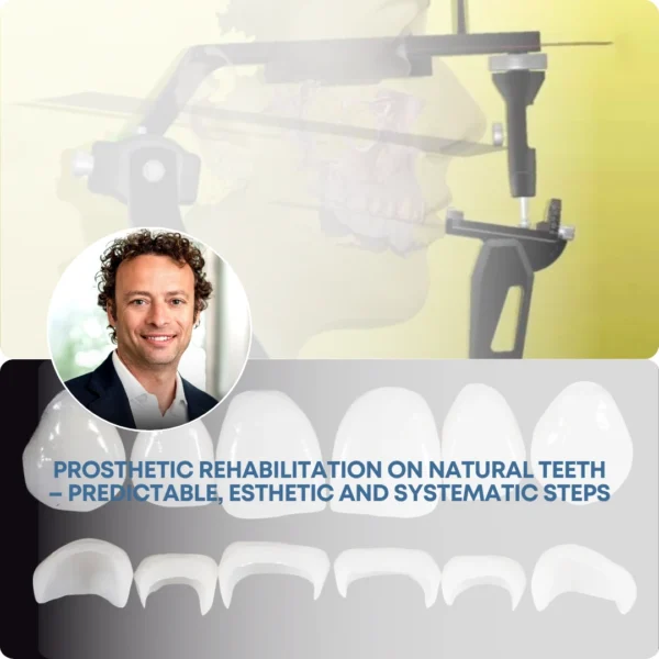 gIDEdental Prosthetic Rehabilitation on Natural Teeth: Predictable, Esthetic and Systematic Steps